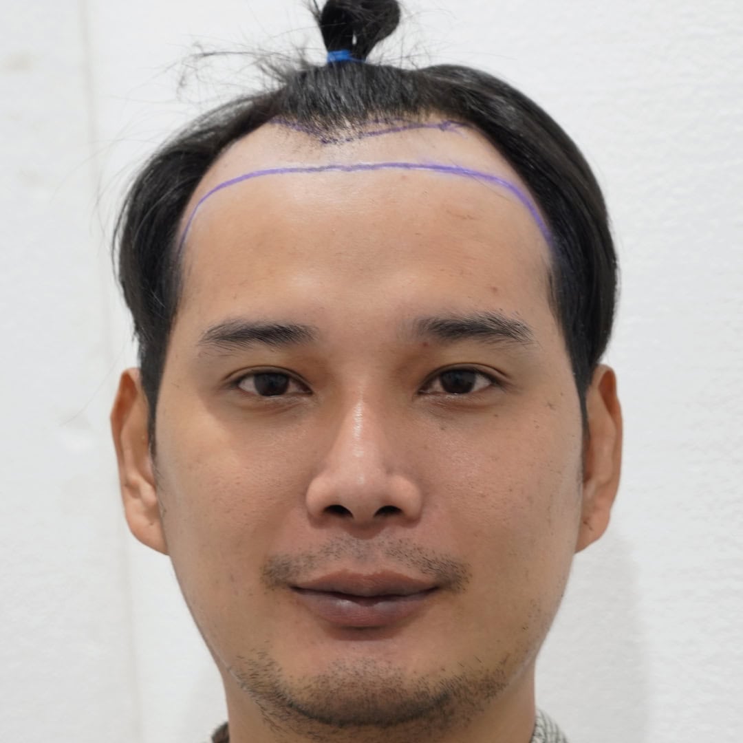 WEB_RW-FUE-พงศภัค2