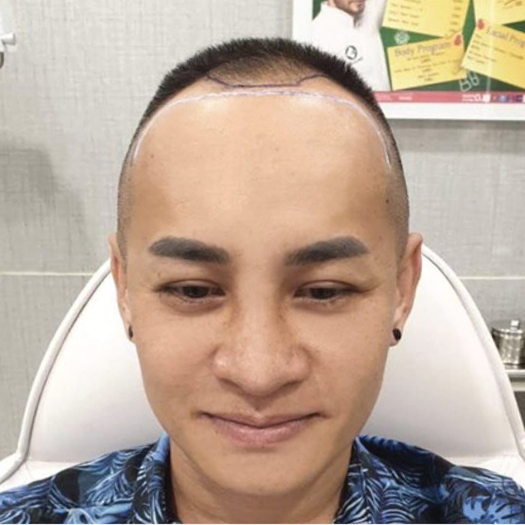 WEB_RW-FUE-เฉลิมพล2