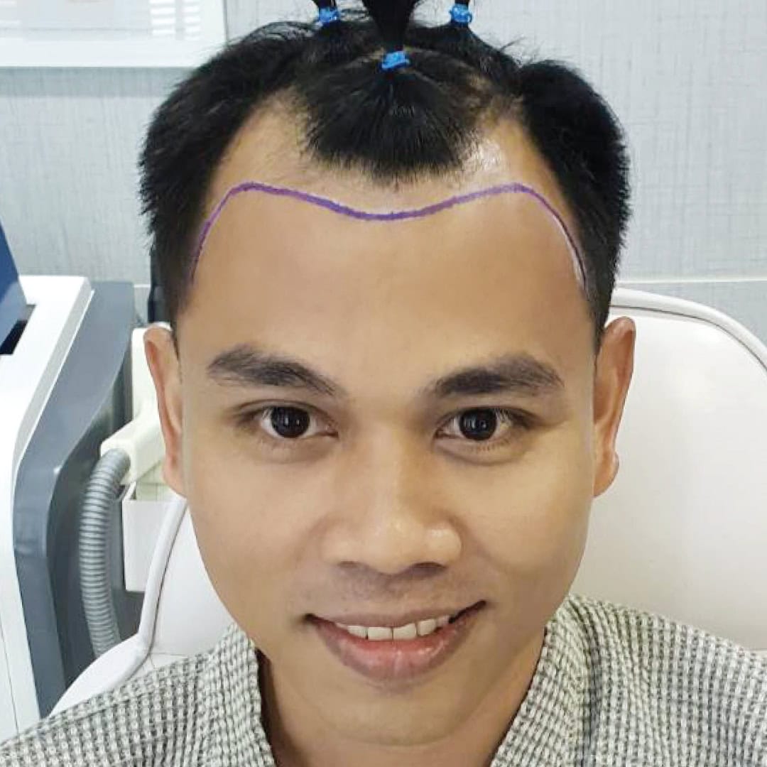 WEB_RW-FUE-สุเมธี1