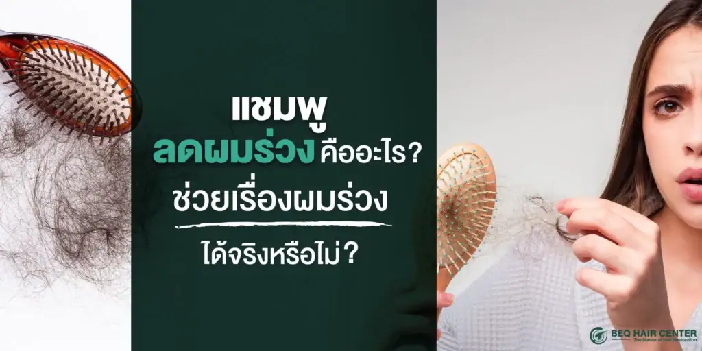 แชมพูลดผมร่วง