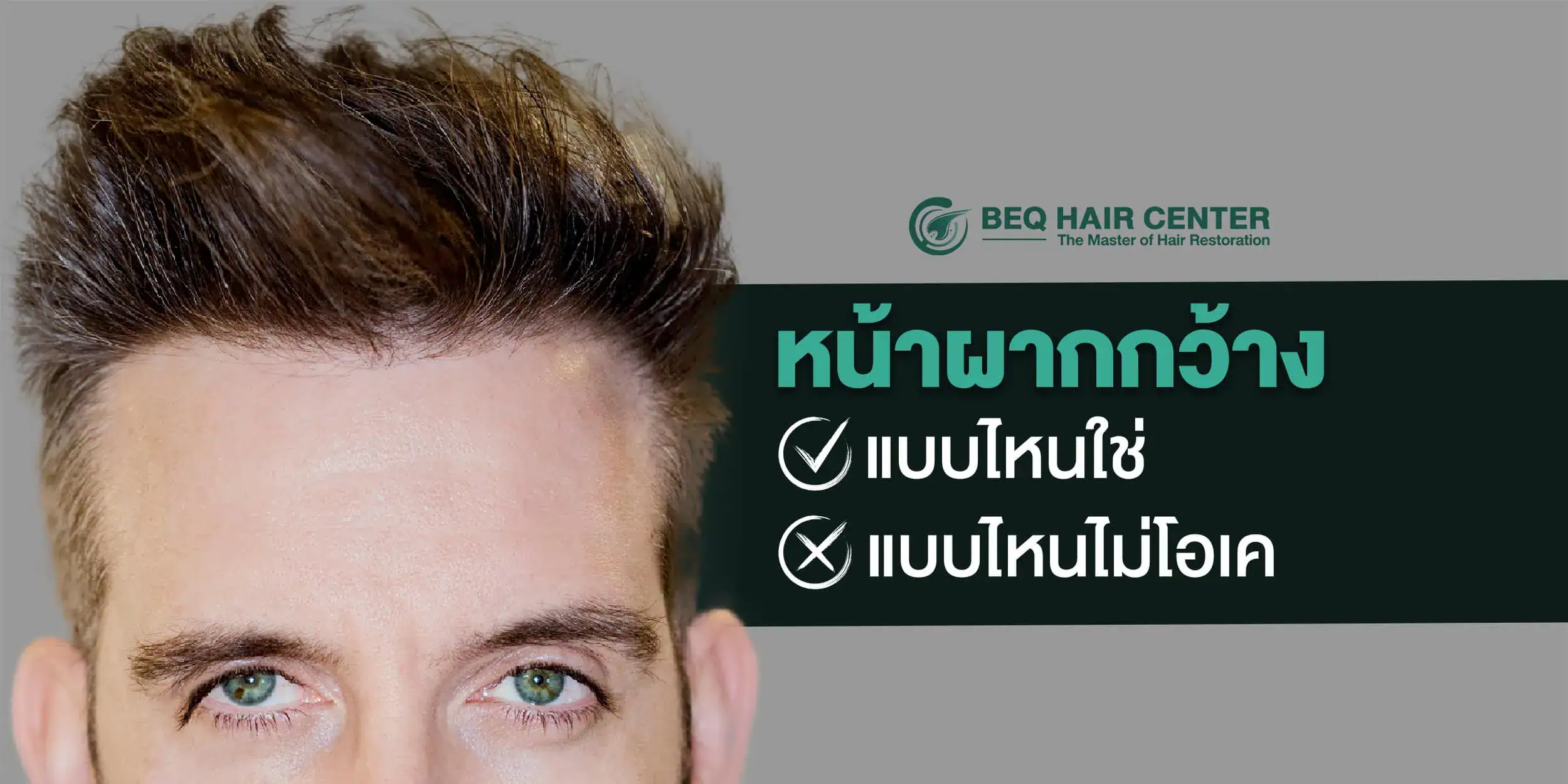 หน้าผากกว้าง
