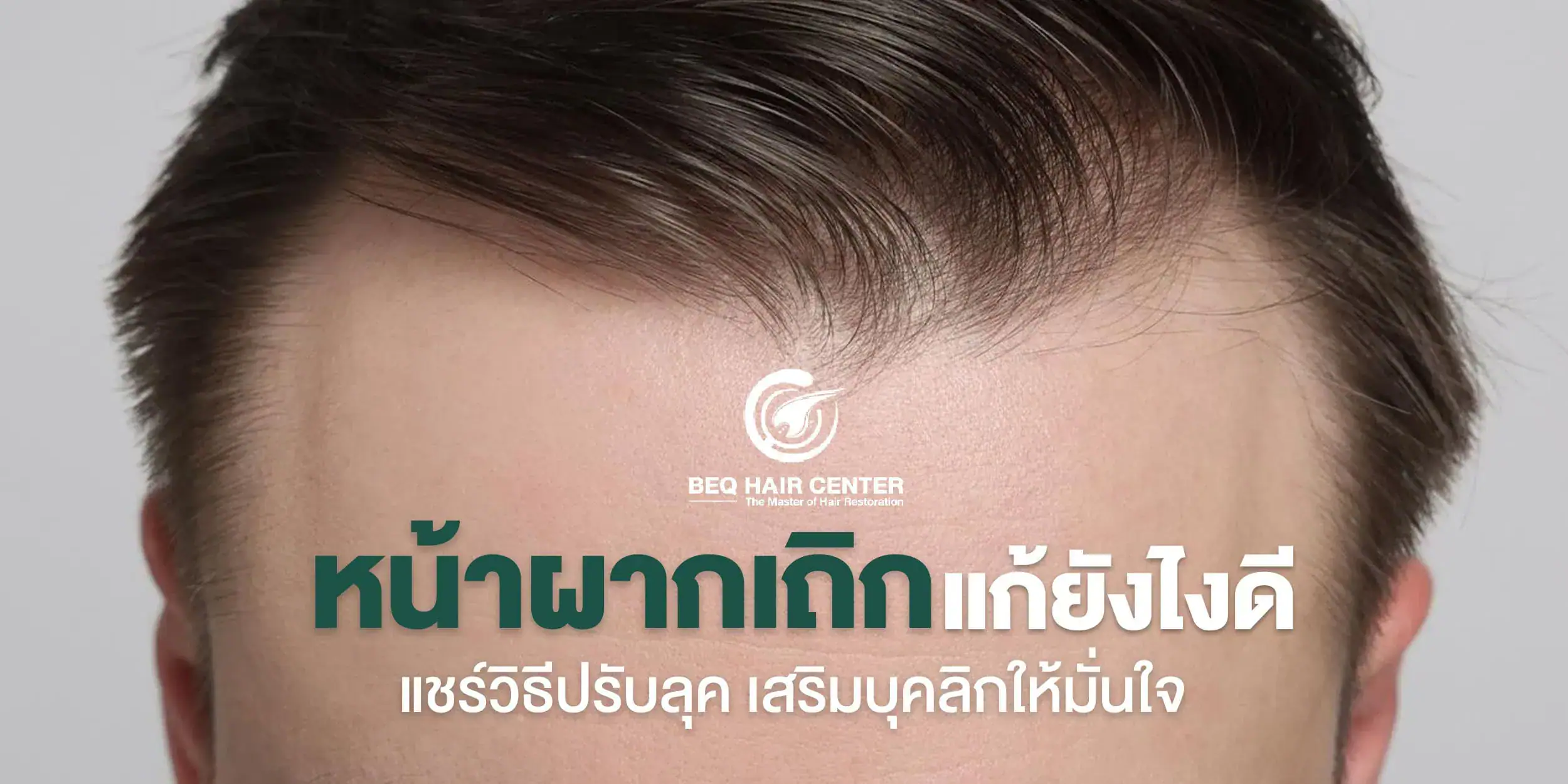 หน้าผากเถิก