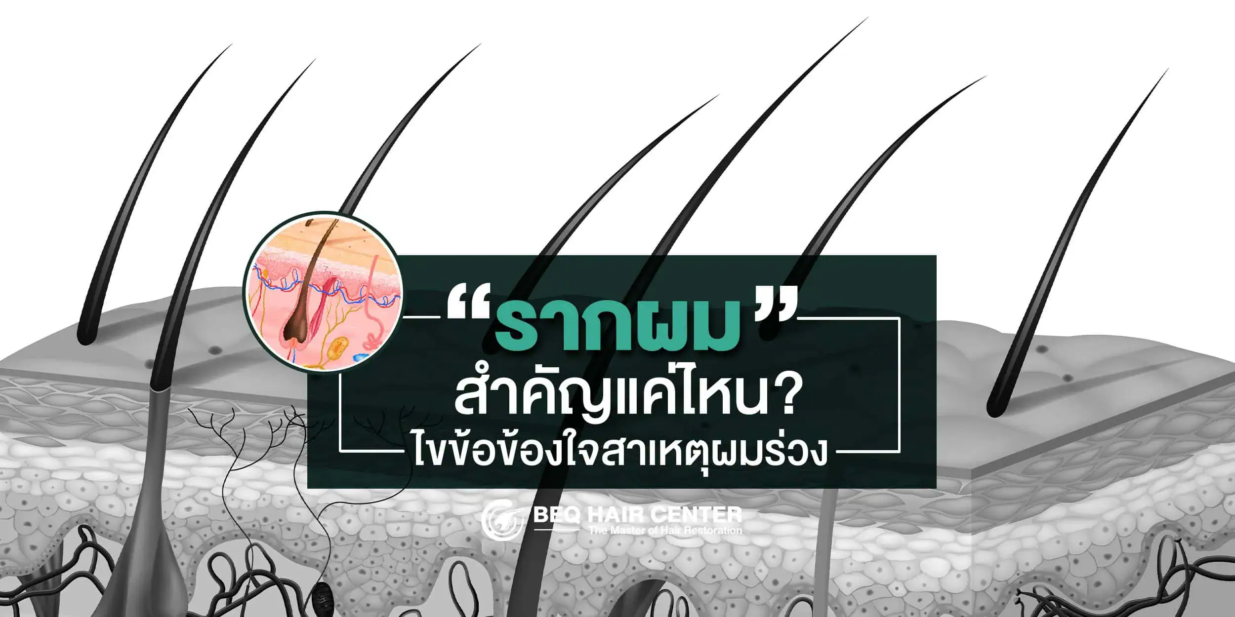 รากผม