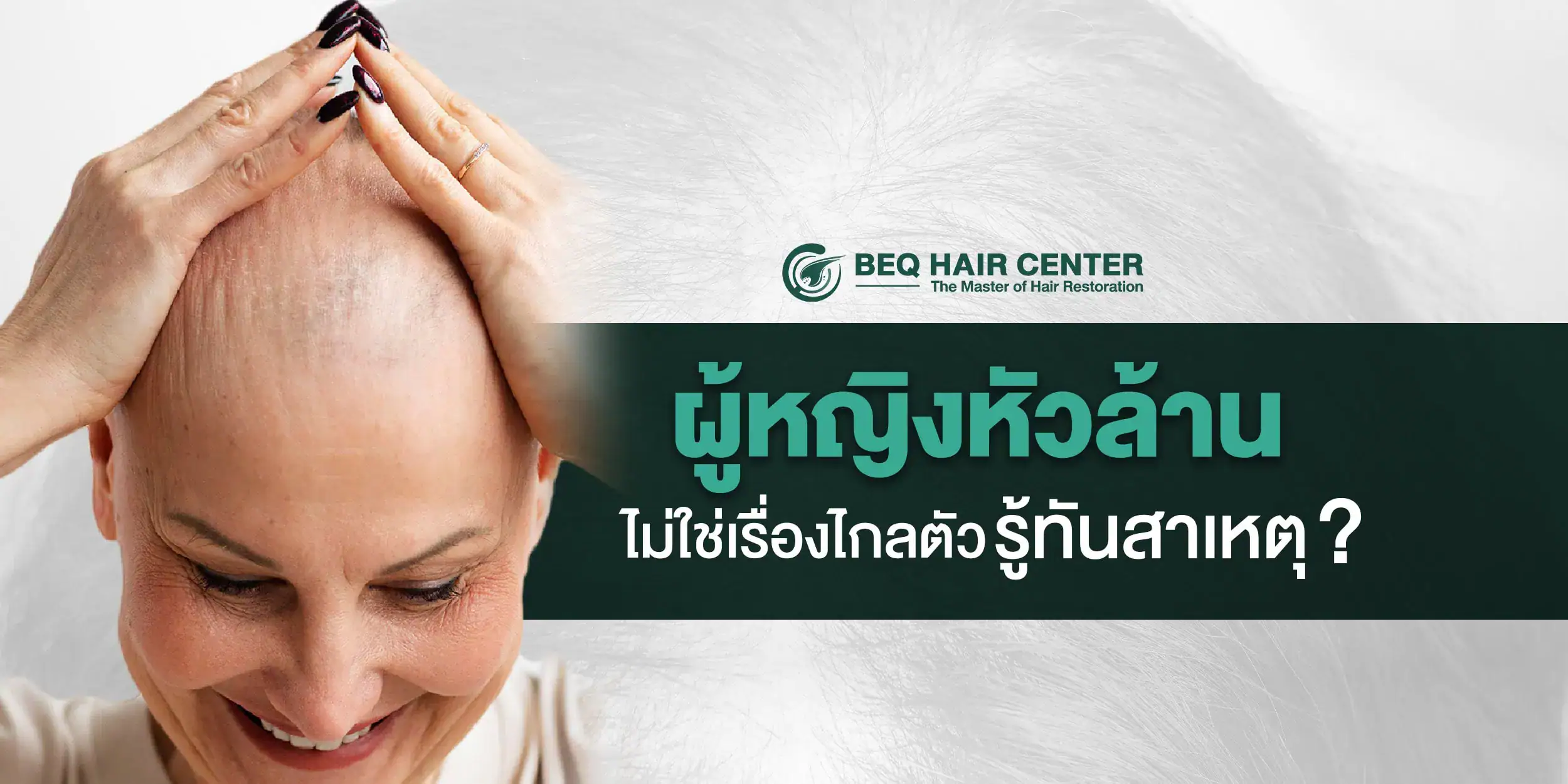 ผู้หญิงหัวล้าน