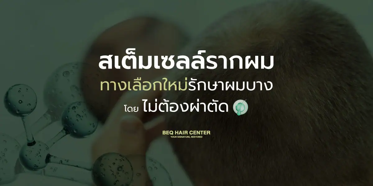 stem cell hair regrowth without surgery guide