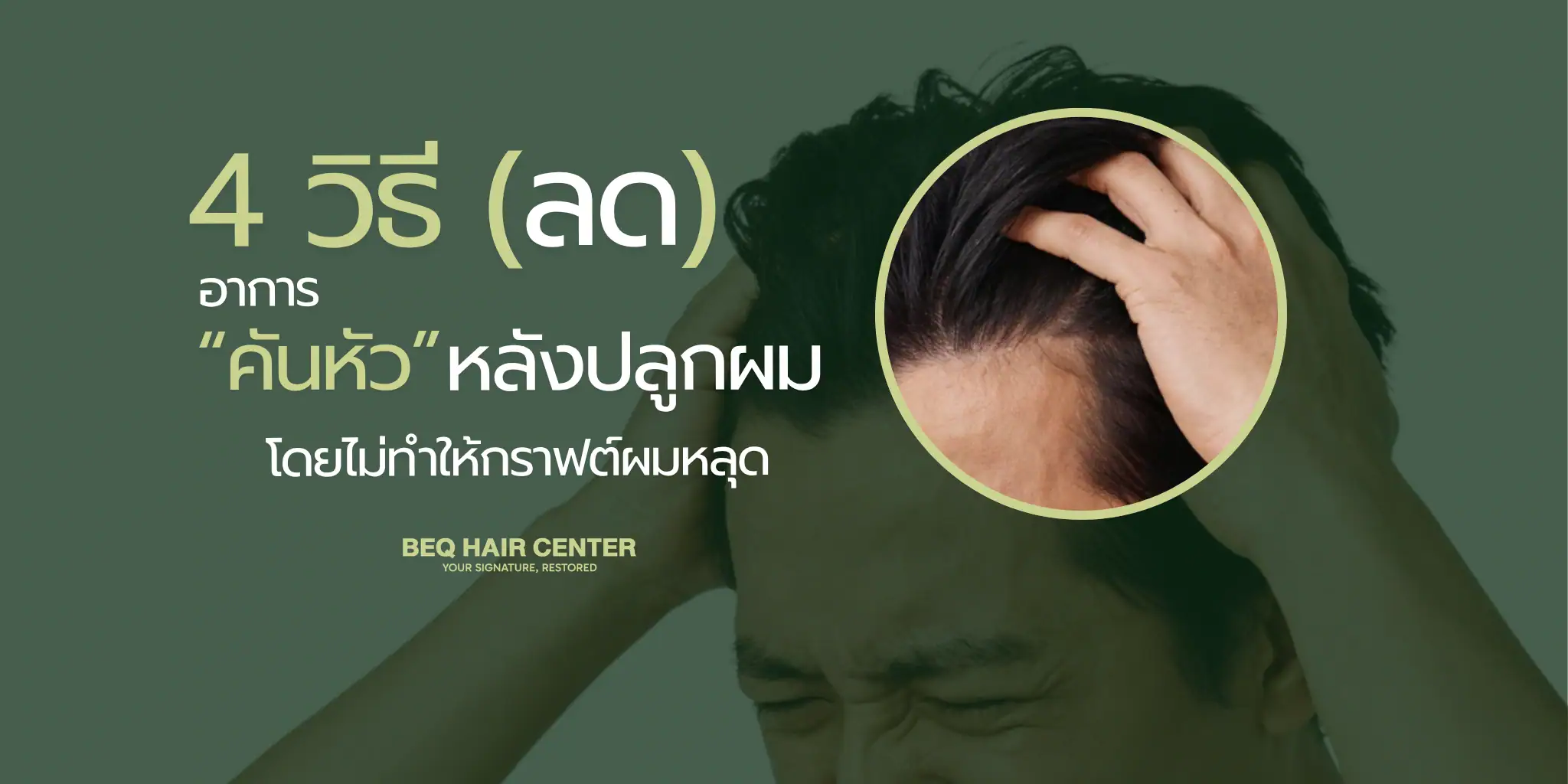 4 ways to stop itchy scalp after hair transplant