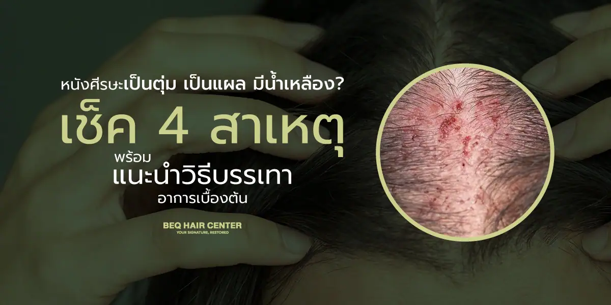 scalp inflammation
