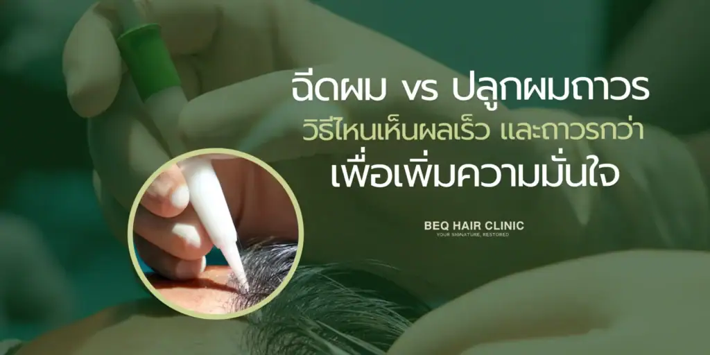 hair injection vs hair transplant