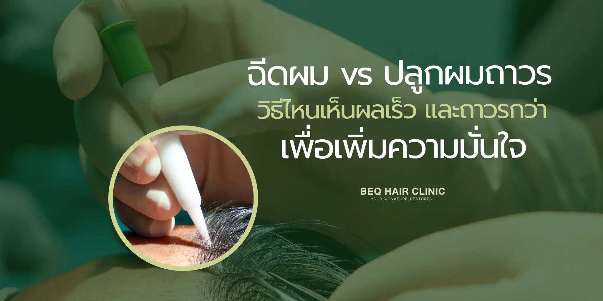 hair injection vs hair transplant