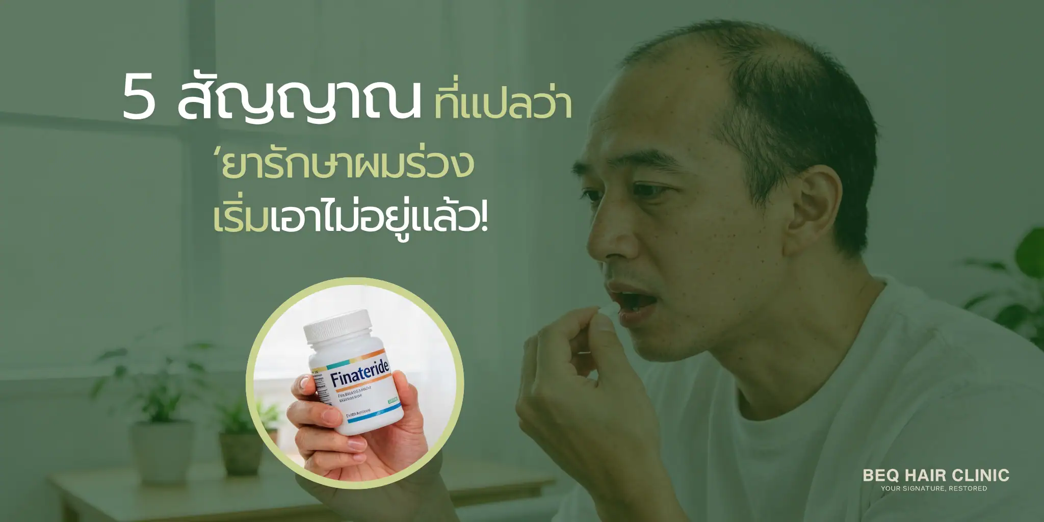 5 signs still losing hair on medication