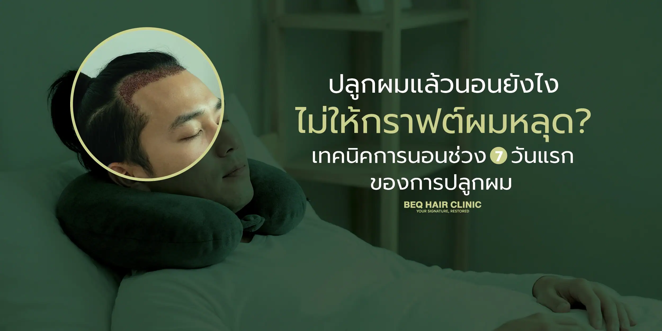 how to sleep after hair transplant