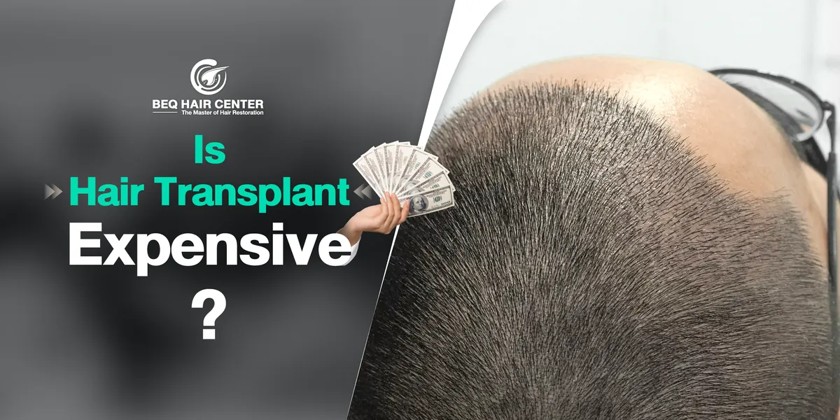 Is Hair Transplant Expensive?