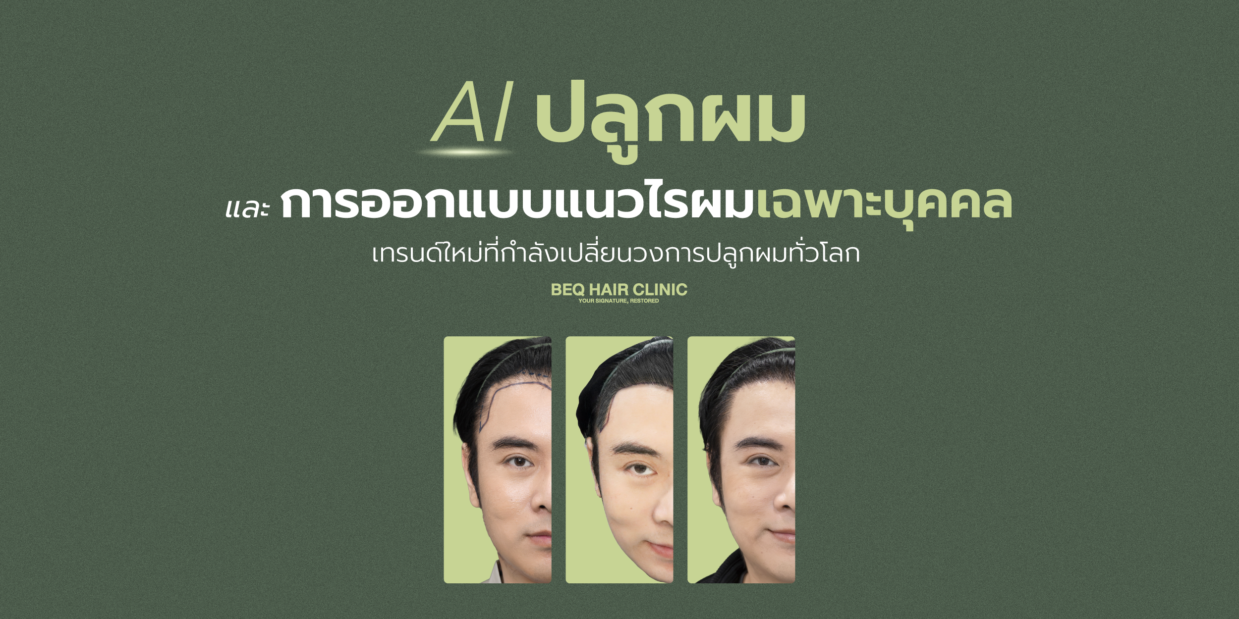 AI ปลูกผม และการออกแบบแนวไรผมเฉพาะบุคคล