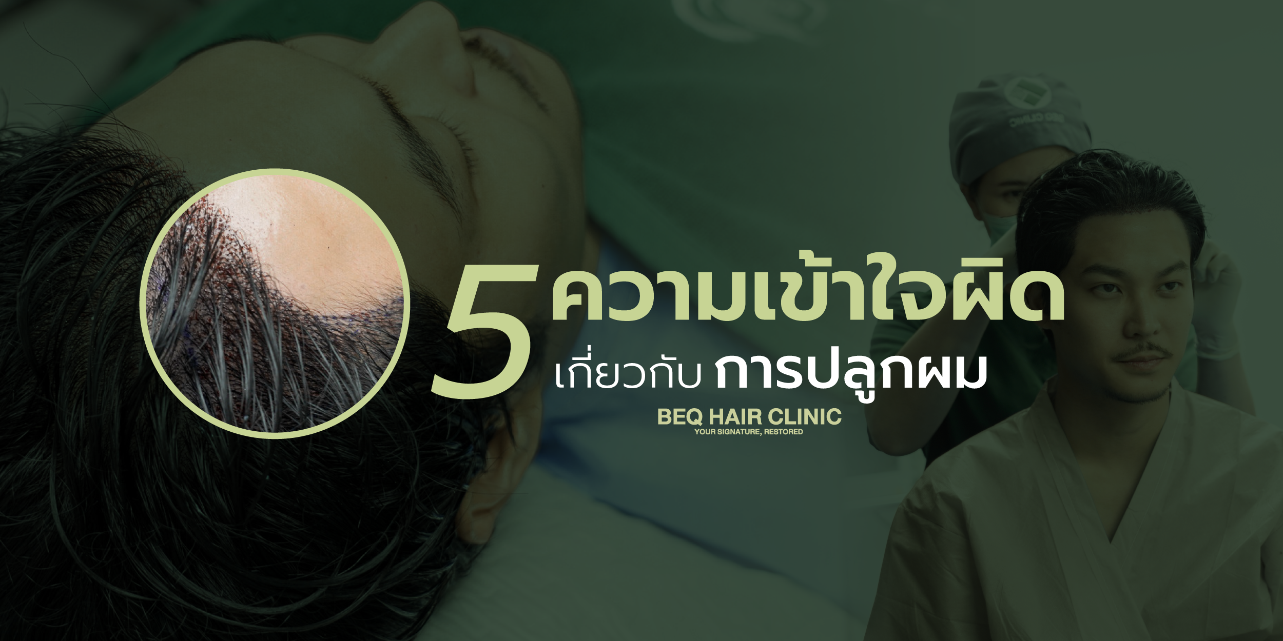 5 ความเข้าใจผิดเกี่ยวกับการปลูกผม