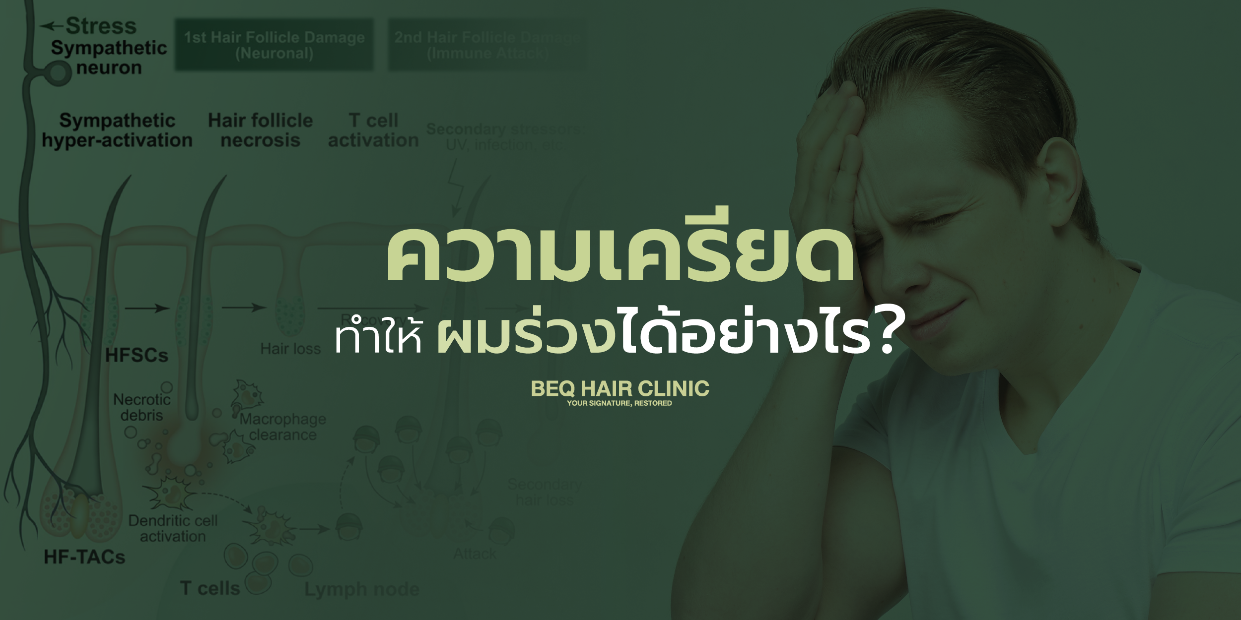 ความเครียดทำให้ผมร่วงได้อย่างไร?