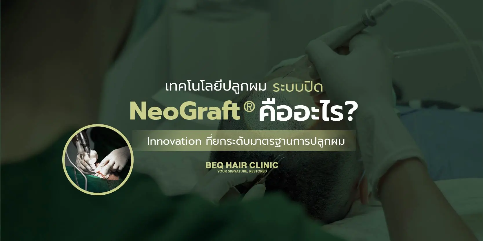 เทคโนโลยีปลูกผมระบบปิด NeoGraft® คืออะไร? Innovation ที่ยกระดับมาตรฐานการปลูกผม